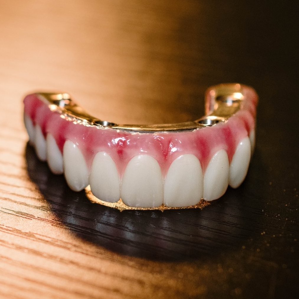 Nuvia Dental Implant Center: New Permanent Teeth Are Just 24 Hours Away!